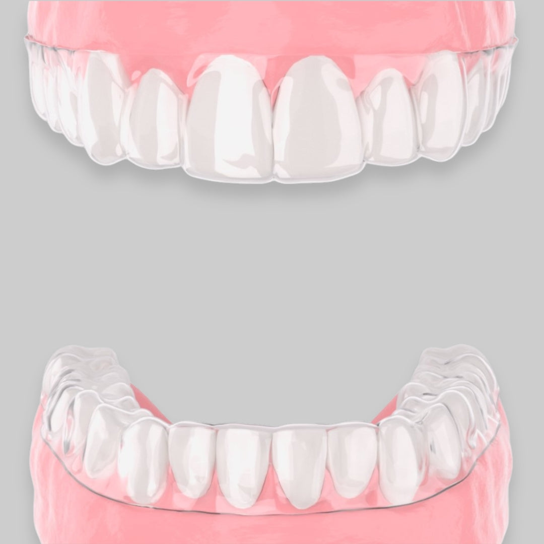 Upper & Lower Retainer + Kit